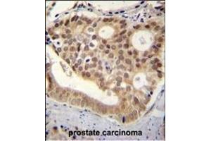 C11orf53 antibody (C-term) (ABIN654875 and ABIN2844531) immunohistochemistry analysis in formalin fixed and paraffin embedded human pancreas tissue followed by peroxidase conjugation of the secondary antibody and DAB staining. (C11orf53 Antikörper  (C-Term))