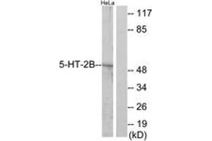 Western Blotting (WB) image for anti-Serotonin Receptor 2B (HTR2B) (AA 261-310) antibody (ABIN2889845) (Serotonin Receptor 2B Antikörper  (AA 261-310))