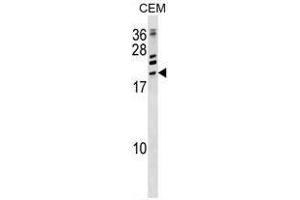 ATF3 Antibody (C-term) western blot analysis in CEM cell line lysates (35ug/lane). (ATF3 Antikörper  (C-Term))