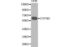 Western blot analysis of extracts of CEM cell lines, using CYP1B1 antibody. (CYP1B1 Antikörper  (AA 1-260))