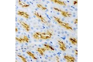 Immunohistochemical analysis of Clathrin Heavy Chain staining in rat kidney formalin fixed paraffin embedded tissue section.