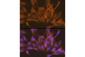 Immunofluorescence analysis of NIH-3T3 cells using PRKACB Rabbit pAb (ABIN6132241, ABIN6146183, ABIN6146184 and ABIN6220953) at dilution of 1:100 (40x lens).