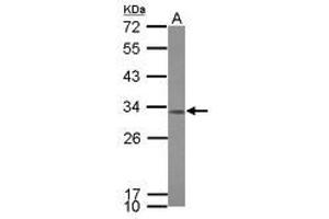 Image no. 1 for anti-Coiled-Coil Domain Containing 44 (CCDC44) (AA 9-105) antibody (ABIN1501284) (TACO1 Antikörper  (AA 9-105))