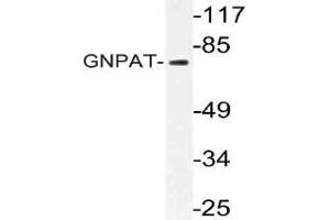 Western blot (WB) analysis of GNPAT antibody in extracts from HT-29 cells. (GNPAT Antikörper)