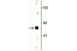 Western blot of rat cortical lysate showing specific labeling of the ~65 kDa synaptotagmin protein. (SYT1 Antikörper)