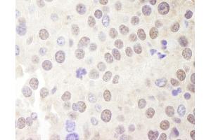 Immunohistochemistry (IHC) image for anti-Multiple Endocrine Neoplasia 1 (MEN1) (C-Term) antibody (ABIN7448666) (Menin Antikörper  (C-Term))
