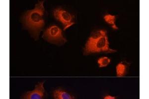 Immunofluorescence analysis of A431 cells using MCL1 Polyclonal Antibody at dilution of 1:100 (40x lens). (MCL-1 Antikörper)
