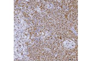 IHC analysis of SP1 using anti-SP1 antibody (ABIN7601559). (SP1 Antikörper  (AA 384-603))