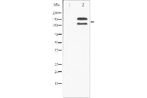 Western blot analysis of FGFR1 phosphorylation expression in 293 whole cell lysates,The lane on the left is treated with the antigen-specific peptide. (FGFR1 Antikörper  (pTyr154))