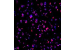 Immunofluorescence of paraffin embedded mouse placenta using Skar (ABIN7074970) at dilution of 1:950 (400x lens) (p46 Antikörper)