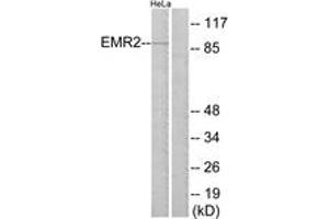 Western blot analysis of extracts from HeLa cells, using EMR2 Antibody.