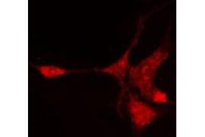 ABIN6276988 staining Hela cells by IF/ICC.