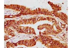 Immunohistochemistry (IHC) image for anti-FK506 Binding Protein 4, 59kDa (FKBP4) (AA 1-240) antibody (ABIN7162837)