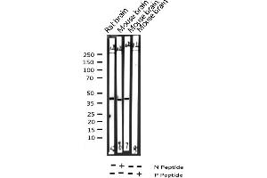 Synaptotagmin Antikörper  (pSer309)