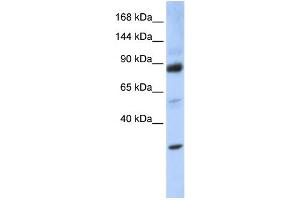 WB Suggested Anti-ZHX3 Antibody Titration: 0. (ZHX3 Antikörper  (Middle Region))