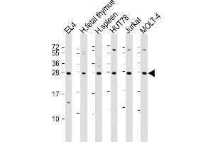 All lanes : Anti-TIGIT Antibody at 1:2000 dilution Lane 1: EL4 whole cell lysate Lane 2: human fetal thymus lysate Lane 3: human spleen lysate Lane 4: HUT78 whole cell lysate Lane 5: Jurkat whole cell lysate Lane 6: MOLT-4 whole cell lysate Lysates/proteins at 20 μg per lane. (TIGIT Antikörper  (AA 12-142))
