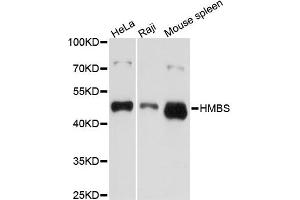 Western blot analysis of extracts of various cell lines, using HMBS antibody (ABIN5970895) at 1/1000 dilution. (HMBS Antikörper)