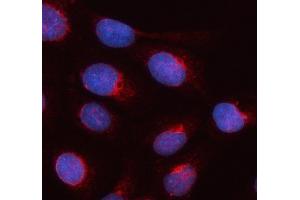 IF analysis of SEC22B using anti-SEC22B antibody (ABIN7602121).