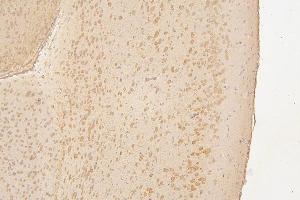 IHC analysis of SEMA3B using anti-SEMA3B antibody (ABIN6719617).