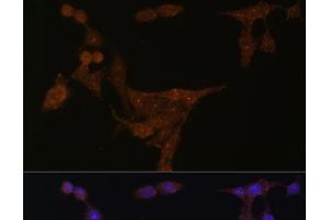 Immunofluorescence analysis of HeLa cells using PPAT Polyclonal Antibody at dilution of 1:100 (40x lens).
