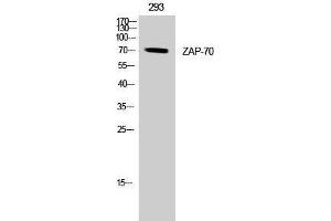 Western Blotting (WB) image for anti-zeta-Chain (TCR) Associated Protein Kinase 70kDa (ZAP70) (Tyr349) antibody (ABIN3187521) (ZAP70 Antikörper  (Tyr349))