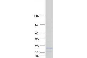 Validation with Western Blot (LYPD2 Protein (Myc-DYKDDDDK Tag))