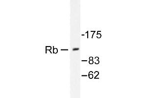 Image no. 2 for anti-Retinoblastoma 1 (RB1) antibody (ABIN271801) (Retinoblastoma 1 Antikörper)