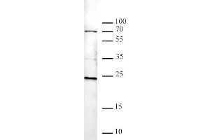 Histone H2AK119ub antibody tested by Western blot. (Histone H2A Antikörper  (ubLys119))