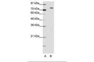 Image no. 1 for anti-MYST Histone Acetyltransferase 2 (MYST2) (N-Term) antibody (ABIN6736157) (MYST2 Antikörper  (N-Term))