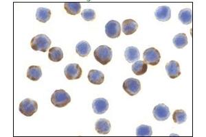 Immunocytochemistry of ATG7 in MCF7 cells with ATG7 Antibody at 10 μg/ml. (ATG7 Antikörper  (C-Term))