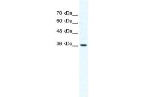 DVL1 antibody used at 2. (DVL1 Antikörper)