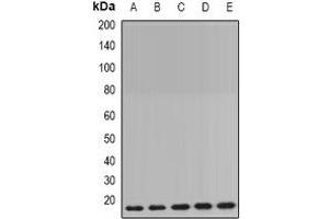 Western blot analysis of Cyclophilin B expression in MCF7 (A), HepG2 (B), mouse brain (C), mouse lung (D), rat liver (E) whole cell lysates.