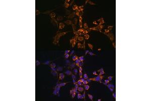 Immunofluorescence analysis of NIH-3T3 cells using Septin 4 Polyclonal Antibody (ABIN6128476, ABIN6147554, ABIN6147555 and ABIN6214410) at dilution of 1:100 (40x lens). (Septin 4 Antikörper  (AA 1-100))