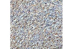 IHC analysis of SYK using anti-SYK antibody (ABIN7599608).