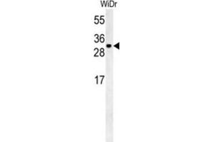 Western Blotting (WB) image for anti-TM2 Domain Containing 3 (TM2D3) antibody (ABIN3002321) (TM2D3 Antikörper)