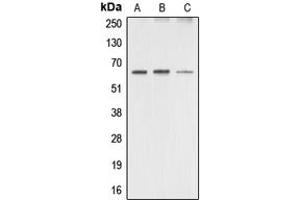 Western blot analysis of AMPK alpha 1/2 expression in HeLa (A), mouse brain (B), rat brain (C) whole cell lysates. (PRKAA1/PRKAA2 Antikörper  (Center))