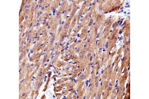 IHC analysis of ACTN2 using anti-ACTN2 antibody (ABIN7602055). (ACTN2 Antikörper  (AA 567-696))