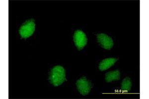 Immunofluorescence of purified MaxPab antibody to C8orf70 on HeLa cell. (FAM164A Antikörper  (AA 1-325))
