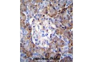 TIMP1 Antibody (C-term) immunohistochemistry analysis in formalin fixed and paraffin embedded human pancreas tissue followed by peroxidase conjugation of the secondary antibody and DAB staining. (TIMP1 Antikörper  (C-Term))