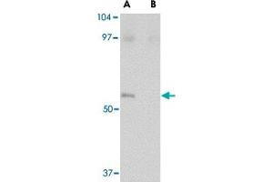 Western blot analysis of LASS5 in SK-N-SH lysate with LASS5 polyclonal antibody  at 1 ug/mL in the (A) absence and (B) presence of blocking peptide.