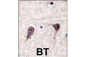 Formalin-fixed and paraffin-embedded human brain tissue reacted with HS2ST1 polyclonal antibody  , which was peroxidase-conjugated to the secondary antibody, followed by DAB staining.