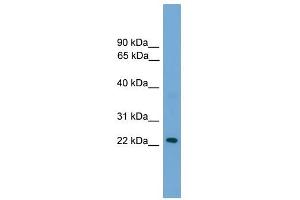 RAB39 antibody used at 1 ug/ml to detect target protein. (RAB39 Antikörper  (N-Term))