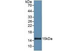 Detection of Recombinant SAA, Human using Monoclonal Antibody to Serum Amyloid A (SAA) (SAA Antikörper  (AA 19-122))
