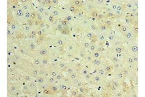 Immunohistochemistry of paraffin-embedded human liver tissue using ABIN7171674 at dilution of 1:100 (TCTN2 Antikörper  (AA 420-670))