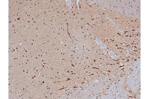 Immunohistochemistry (IHC) image for anti-Tyrosine Hydroxylase (TH) (pSer40) antibody (ABIN6255304)