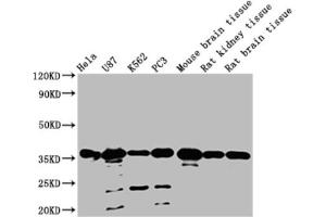 Western blot All lanes: METRNL antibody at 2 μg/mL Lane 1: Mouse small intestine tissue Lane 2: Mouse kidney tissue Lane 3: Rat gonadal tissue Lane 4: Mouse brain tissue Secondary Goat polyclonal to rabbit IgG at 1/10000 dilution Predicted band size: 35, 26 kDa Observed band size: 35 kDa (METRNL Antikörper  (AA 46-311))