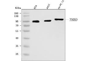 Western blot analysis of Thrombomodulin/THBD using anti-Thrombomodulin/THBD antibody (ABIN7601141). (Thrombomodulin Antikörper  (AA 29-575))
