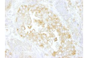 Immunohistochemistry (IHC) image for anti-rho GTPase Activating Protein 1 (ARHGAP1) (AA 1-50) antibody (ABIN7448467) (ARHGAP1 Antikörper  (AA 1-50))