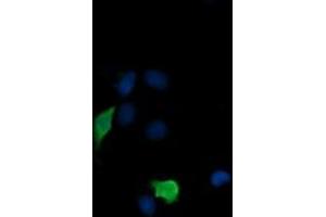 Image no. 3 for anti-Mitogen-Activated Protein Kinase Kinase 3 (MAP2K3) antibody (ABIN1499412) (MAP2K3 Antikörper)