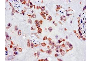 Immunohistochemistry of paraffin-embedded human placenta tissue using ABIN7147677 at dilution of 1:100 (SLC18A1 Antikörper  (AA 66-120))